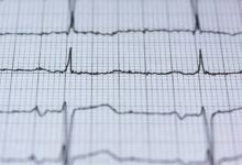 digital node fusion pulse